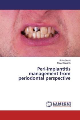 Gupta / Kaushik | Peri-implantitis management from periodontal perspective | Buch | 978-3-659-89072-7 | sack.de
