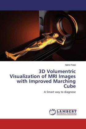 Patel |  3D Volumentric Visualization of MRI Images with Improved Marching Cube | Buch |  Sack Fachmedien