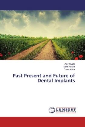 Gupta / Narula / Kalra |  Past Present and Future of Dental Implants | Buch |  Sack Fachmedien