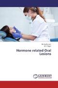 Kumari / Rajan |  Hormone related Oral Lesions | Buch |  Sack Fachmedien