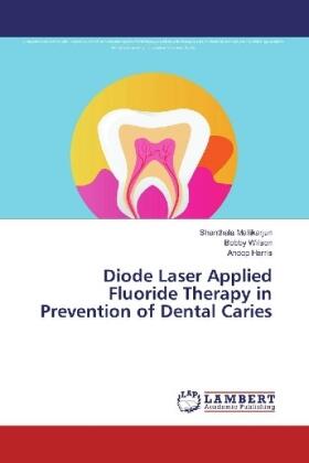 Mallikarjun / Wilson / Harris |  Diode Laser Applied Fluoride Therapy in Prevention of Dental Caries | Buch |  Sack Fachmedien