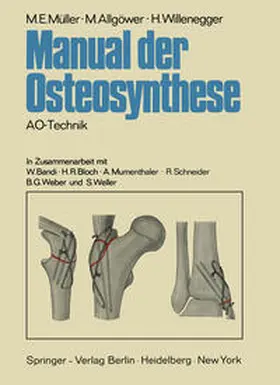 Müller / Allgöwer / Willenegger |  Manual der Osteosynthese | eBook | Sack Fachmedien