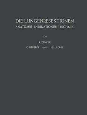 Zenker / Heberer / Löhr |  Die Lungenresektionen | eBook | Sack Fachmedien