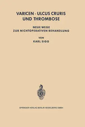 Sigg |  Varicen - Ulcus Cruris und Thrombose | eBook | Sack Fachmedien