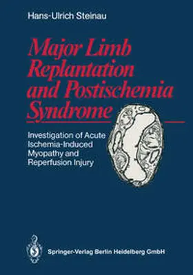 Steinau | Major Limb Replantation and Postischemia Syndrome | E-Book | www.sack.de
