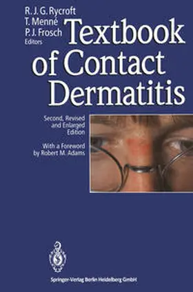 Rycroft / Menne / Frosch |  Textbook of Contact Dermatitis | eBook | Sack Fachmedien