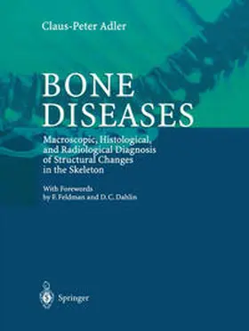 Adler |  Bone Diseases | eBook | Sack Fachmedien