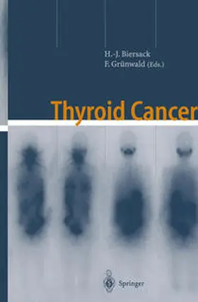 Biersack / Grünwald |  Thyroid Cancer | eBook | Sack Fachmedien