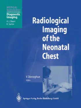 Donoghue |  Radiological Imaging of the Neonatal Chest | eBook | Sack Fachmedien