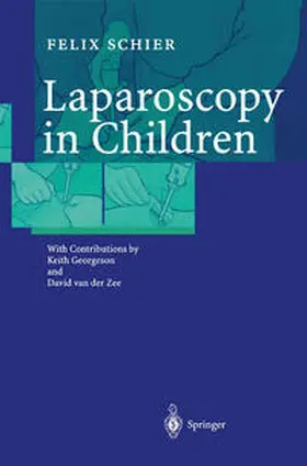 Schier | Laparoscopy in Children | E-Book | www.sack.de