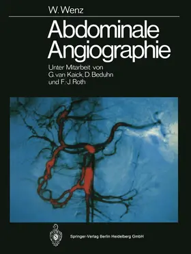 Wenz |  Abdominale Angiographie | Buch |  Sack Fachmedien