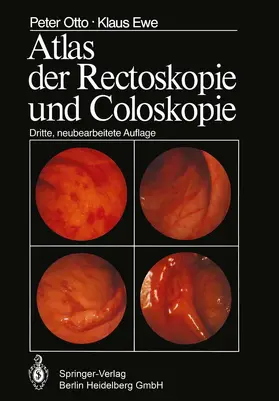 Otto / Ewe |  Atlas der Rectoskopie und Coloskopie | Buch |  Sack Fachmedien