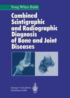Bahk |  Combined Scintigraphic and Radiographic Diagnosis of Bone and Joint Diseases | eBook | Sack Fachmedien