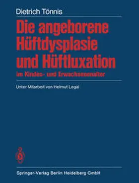 Tönnis |  Die angeborene Hüftdysplasie und Hüftluxation im Kindes- und Erwachsenenalter | eBook | Sack Fachmedien