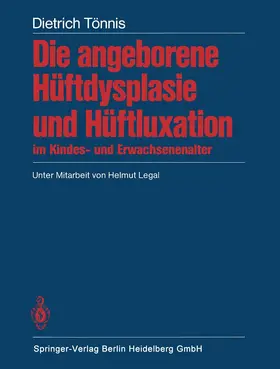 Tönnis |  Die angeborene Hüftdysplasie und Hüftluxation im Kindes- und Erwachsenenalter | Buch |  Sack Fachmedien