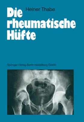 Thabe |  Die rheumatische Hüfte | eBook | Sack Fachmedien