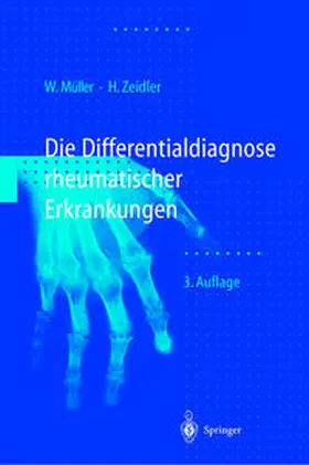Müller / Zeidler / Schilling |  Differentialdiagnose rheumatischer Erkrankungen | eBook | Sack Fachmedien
