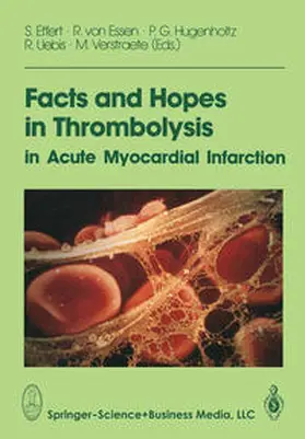 Effert |  Facts and Hopes in Thrombolysis in Acute Myocardial Infarction | eBook | Sack Fachmedien