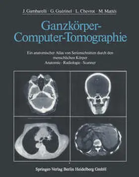 Gambarelli / Guerinel / Chevrot |  Ganzkörper-Computer-Tomographie | eBook | Sack Fachmedien