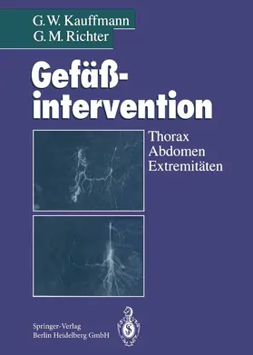 Kauffmann / Richter |  Gefäßintervention | Buch |  Sack Fachmedien