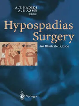 Hadidi / David A. |  Hypospadias Surgery | eBook | Sack Fachmedien