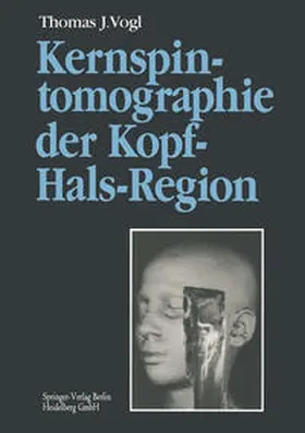 Vogl |  Kernspintomographie der Kopf-Hals-Region | eBook | Sack Fachmedien