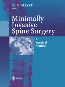Mayer |  Minimally Invasive Spine Surgery | eBook | Sack Fachmedien