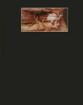 Thiel |  Photographischer Atlas der Praktischen Anatomie II | eBook | Sack Fachmedien