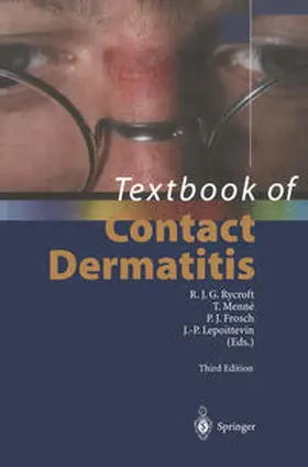 Rycroft / Menne / Frosch |  Textbook of Contact Dermatitis | eBook | Sack Fachmedien