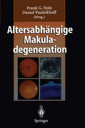 Holz / Pauleikhoff |  Altersabhängige Makuladegeneration | eBook | Sack Fachmedien