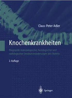 Adler |  Knochenkrankheiten | eBook | Sack Fachmedien