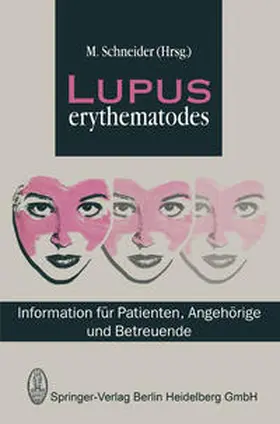 Schneider |  Lupus Erythematodes | eBook | Sack Fachmedien