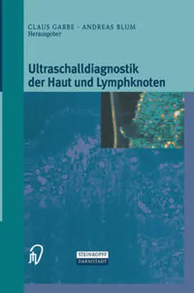Garbe / Blum |  Ultraschalldiagnostik der Haut und Lymphknoten | eBook | Sack Fachmedien