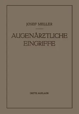 Meller | Augenärztliche Eingriffe | Buch | 978-3-662-27846-8 | www.sack.de