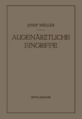 Meller | Augenärztliche Eingriffe | E-Book | www.sack.de