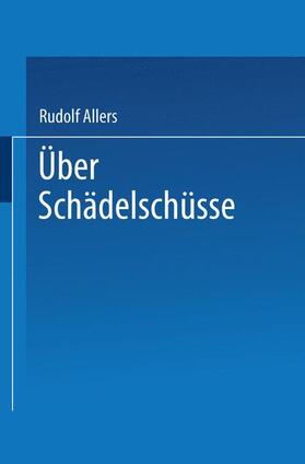 Allers | Über Schädelschüsse | Buch | 978-3-662-39139-6 | sack.de