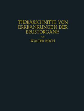 Koch | Thoraxschnitte von Erkrankungen der Brustorgane | Buch | sack.de