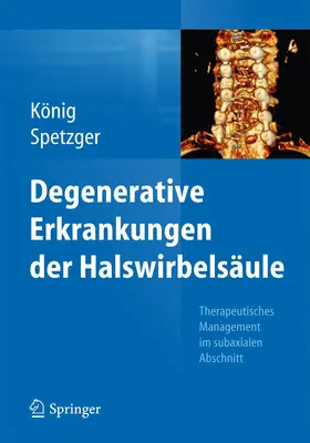 König / Spetzger |  Degenerative Erkrankungen der Halswirbelsäule | Buch |  Sack Fachmedien