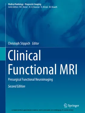 Stippich |  Clinical Functional MRI | eBook | Sack Fachmedien