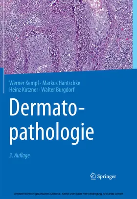 Kempf / Hantschke / Kutzner |  Dermatopathologie | eBook | Sack Fachmedien
