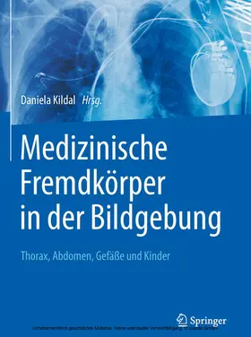 Kildal | Medizinische Fremdkörper in der Bildgebung | E-Book | www.sack.de