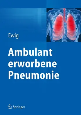 Ewig | Ambulant erworbene Pneumonie | E-Book | www.sack.de