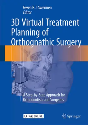 Swennen |  3D Virtual Treatment Planning of Orthognathic Surgery | Buch |  Sack Fachmedien