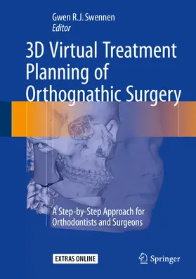 Swennen | 3D Virtual Treatment Planning of Orthognathic Surgery | E-Book | sack.de