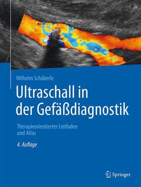 Schäberle | Ultraschall in der Gefäßdiagnostik | Buch | sack.de