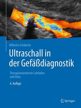 Schäberle | Ultraschall in der Gefäßdiagnostik | E-Book | sack.de