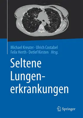 Kreuter / Costabel / Herth |  Seltene Lungenerkrankungen | eBook | Sack Fachmedien