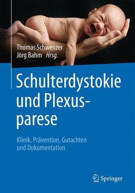 Schwenzer / Bahm |  Schulterdystokie und Plexusparese | Buch |  Sack Fachmedien