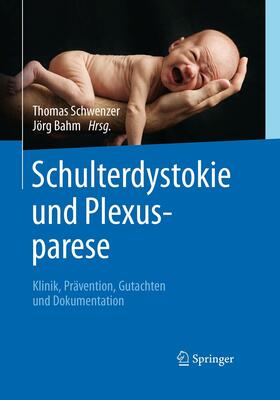 Schwenzer / Bahm | Schulterdystokie und Plexusparese | E-Book | sack.de
