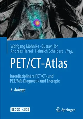 Mohnike / Hör / Hertel |  PET/CT-Atlas | Buch |  Sack Fachmedien